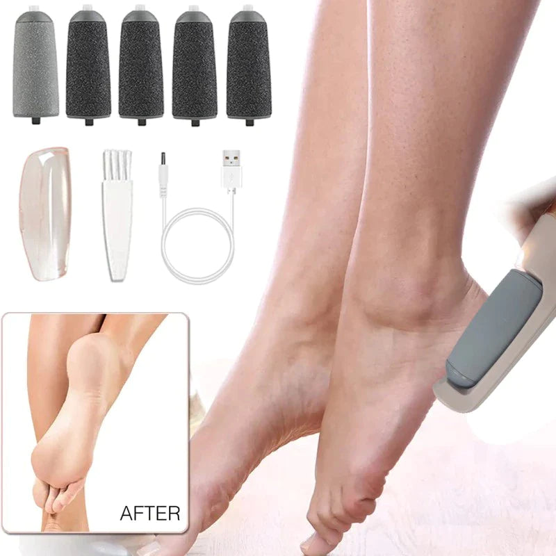 Rechargeable Electric Callus Remover – 2 Speeds, LED, 3 Rollers, USB-C