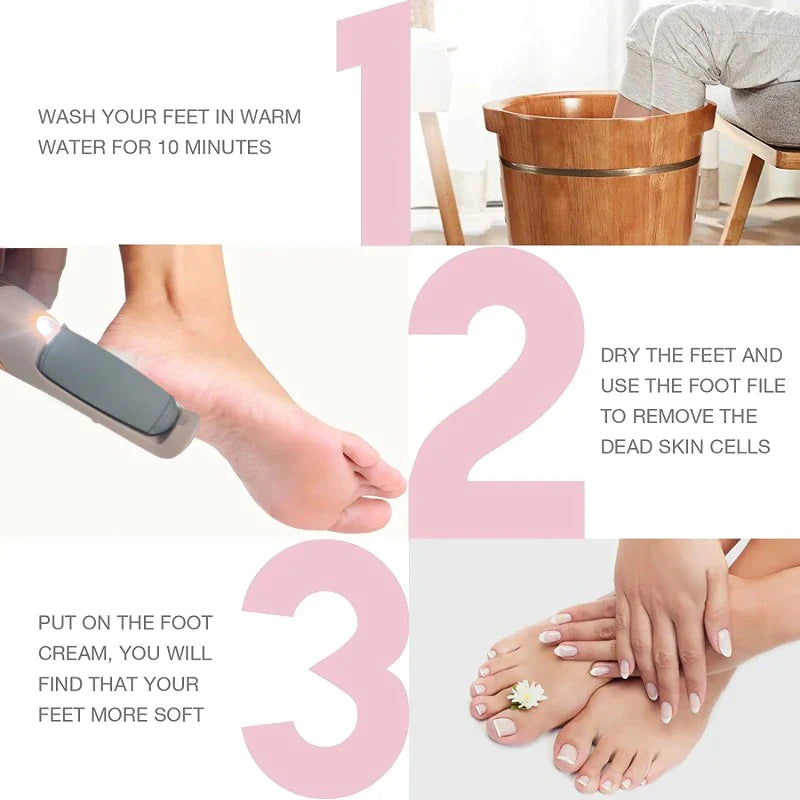 Rechargeable Electric Callus Remover – 2 Speeds, LED, 3 Rollers, USB-C