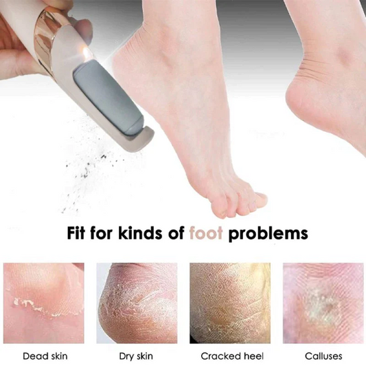 Rechargeable Electric Callus Remover – 2 Speeds, LED, 3 Rollers, USB-C